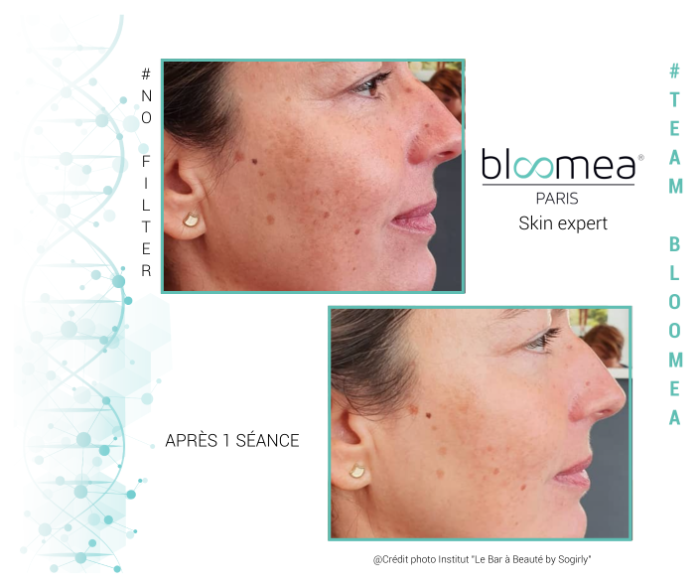 visage bloomea
